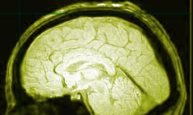 cervello